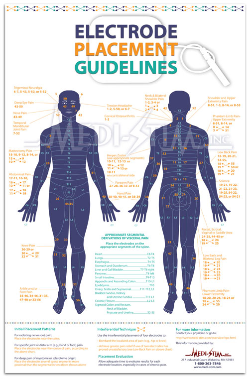 Electrode Placement Chart